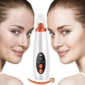 Electric Blackhead Remover
